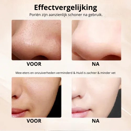 Pryme™ DermaLuxe Huidreiniger